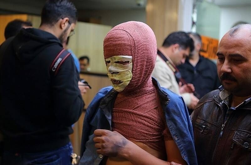 سوختگی چهارشنبه سوری