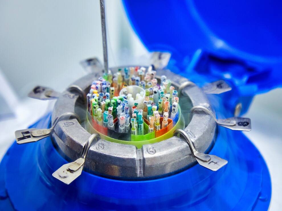 مخزن نگهداری اسپرم در آزمایشگاه